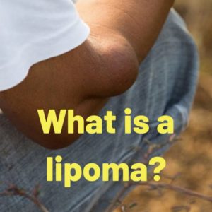 What is a lipoma