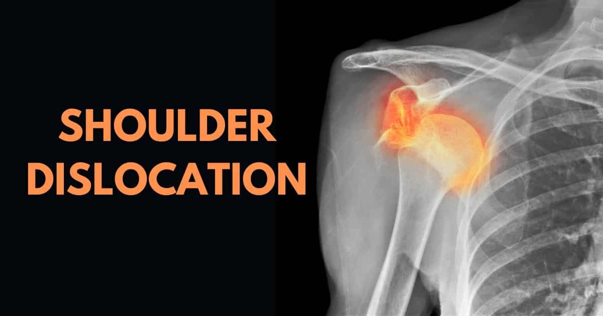 xray shoulder dislocation