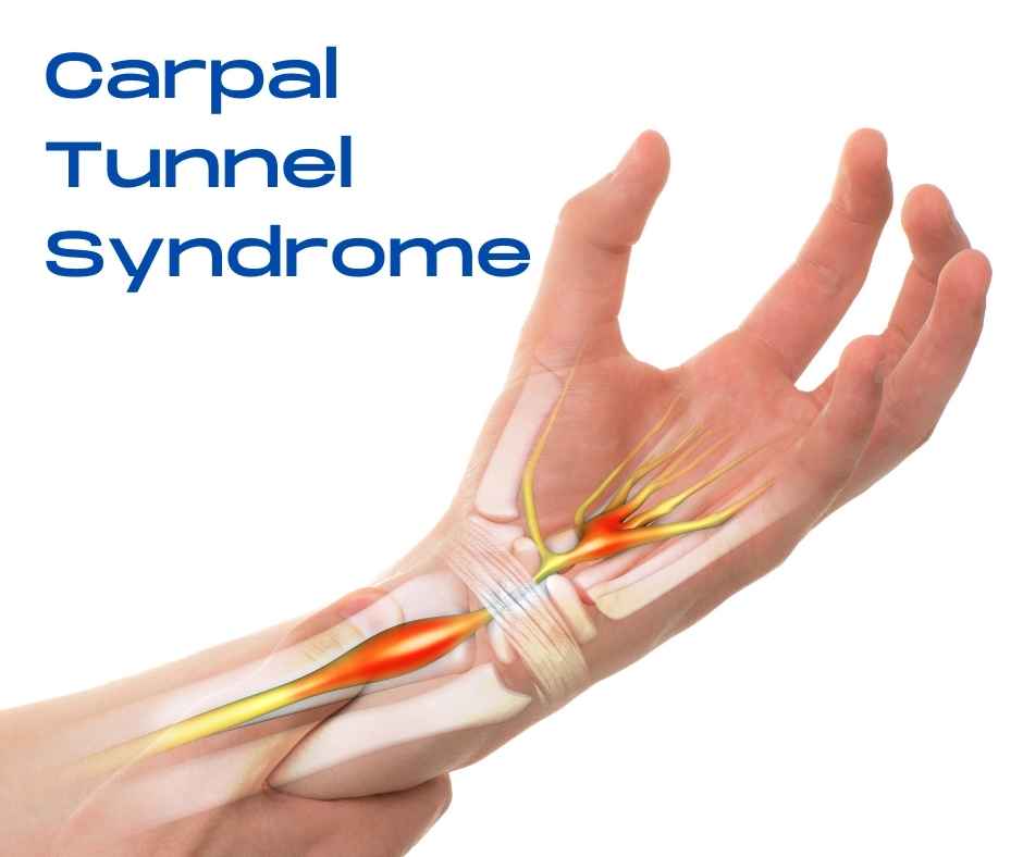 carpal tunnel self test