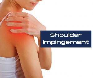 What is shoulder impingement